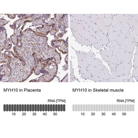 Merck Anti-MYH10 antibody produced in rabbit