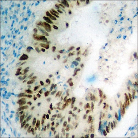 Merck Anti-phospho-p53 (pSer392) antibody produced in rabbit