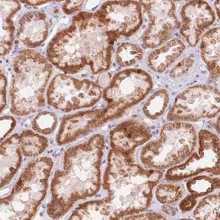 Merck Anti-TIMM13 antibody produced in rabbit