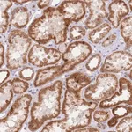 Merck Anti-TIMM13 antibody produced in rabbit