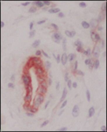 Merck Anti-Collagen Type IV antibody, Mouse monoclonal