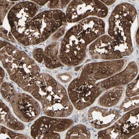 Merck Anti-IGFBP6 antibody produced in rabbit
