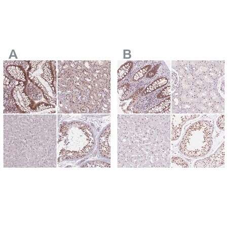 Merck Anti-ZC3H14 antibody produced in rabbit