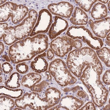 Merck Anti-KCNH3 antibody produced in rabbit