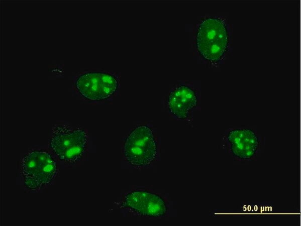 Merck Monoclonal Anti-FBL antibody produced in mouse