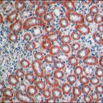 Merck Anti-Claudin-1 antibody produced in rabbit