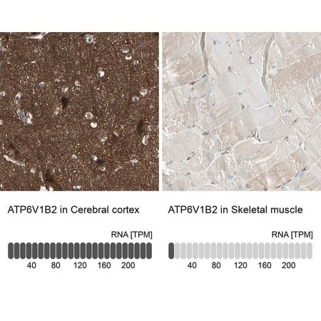 Merck Anti-ATP6V1B2 antibody produced in rabbit