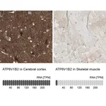 Merck Anti-ATP6V1B2 antibody produced in rabbit