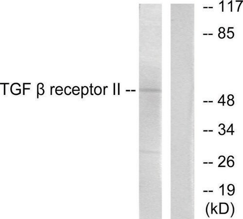 Merck Anti-TGF beta Receptor II antibody produced in rabbit