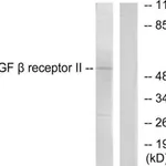 Merck Anti-TGF beta Receptor II antibody produced in rabbit