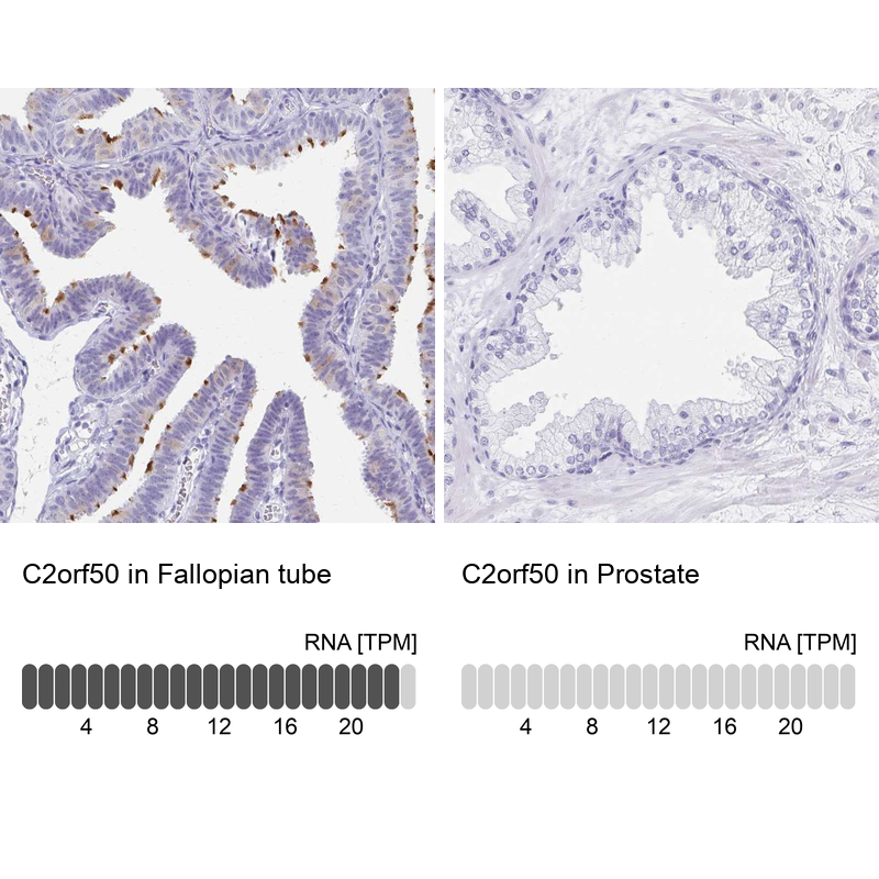 Atlas Antibodies Anti-C2orf50 Antibody
