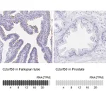 Atlas Antibodies Anti-C2orf50 Antibody