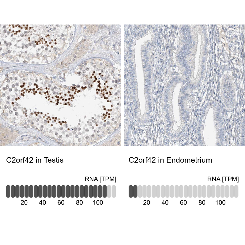 Atlas Antibodies Anti-C2orf42 Antibody