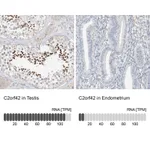 Atlas Antibodies Anti-C2orf42 Antibody