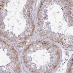 Atlas Antibodies Anti-C2orf61 Antibody