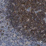 Atlas Antibodies Anti-C2orf66 Antibody