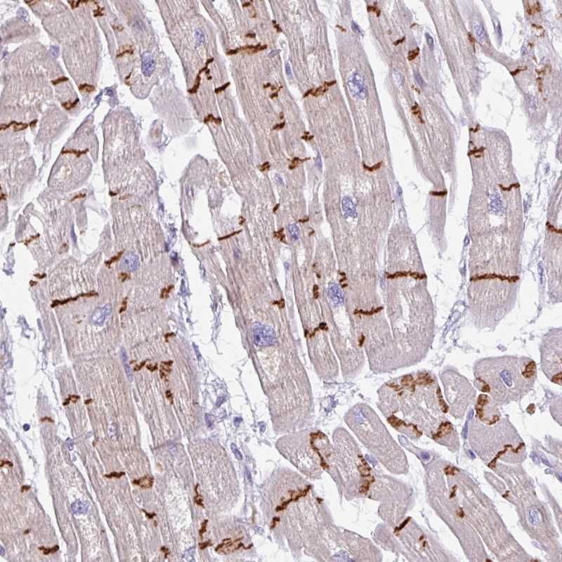 Atlas Antibodies Anti-C2orf68 Antibody