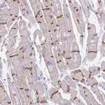 Atlas Antibodies Anti-C2orf68 Antibody