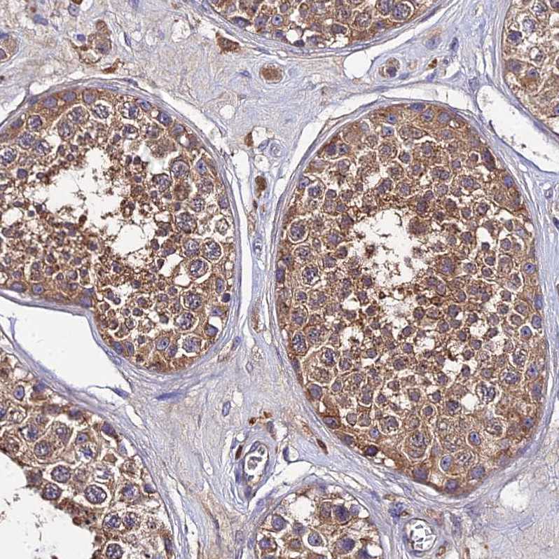 Atlas Antibodies Anti-C2orf69 Antibody