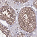 Atlas Antibodies Anti-C2orf69 Antibody