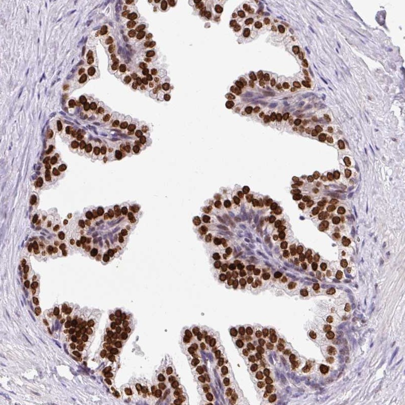 Atlas Antibodies Anti-C2orf71 Antibody