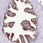 Atlas Antibodies Anti-C2orf71 Antibody