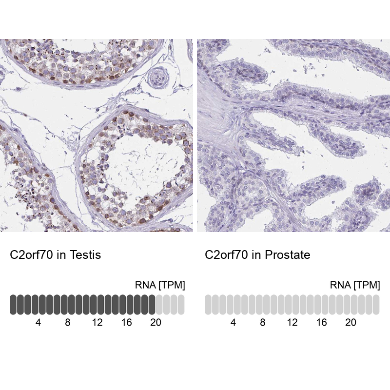 Atlas Antibodies Anti-C2orf70 Antibody