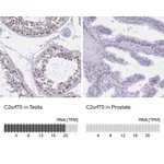 Atlas Antibodies Anti-C2orf70 Antibody