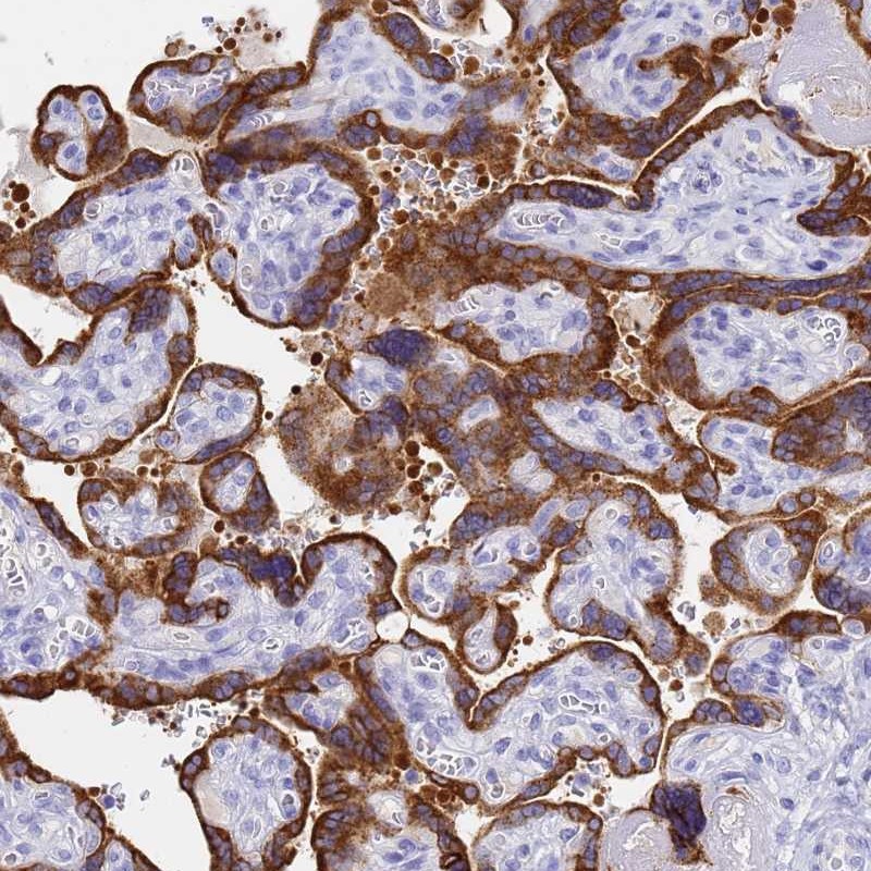Atlas Antibodies Anti-C2orf72 Antibody