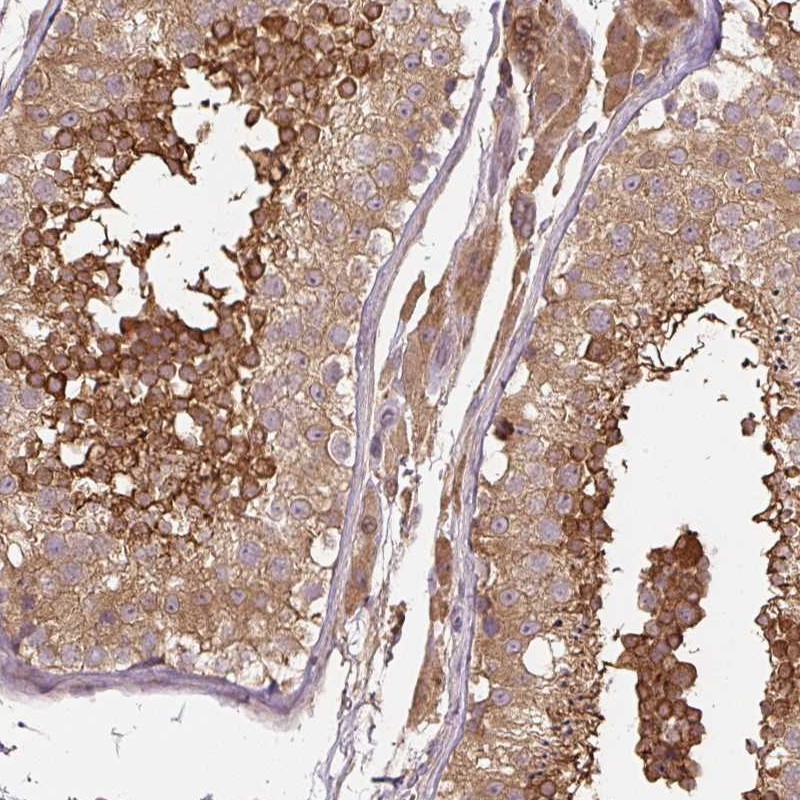 Atlas Antibodies Anti-C2orf73 Antibody