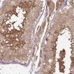 Atlas Antibodies Anti-C2orf73 Antibody