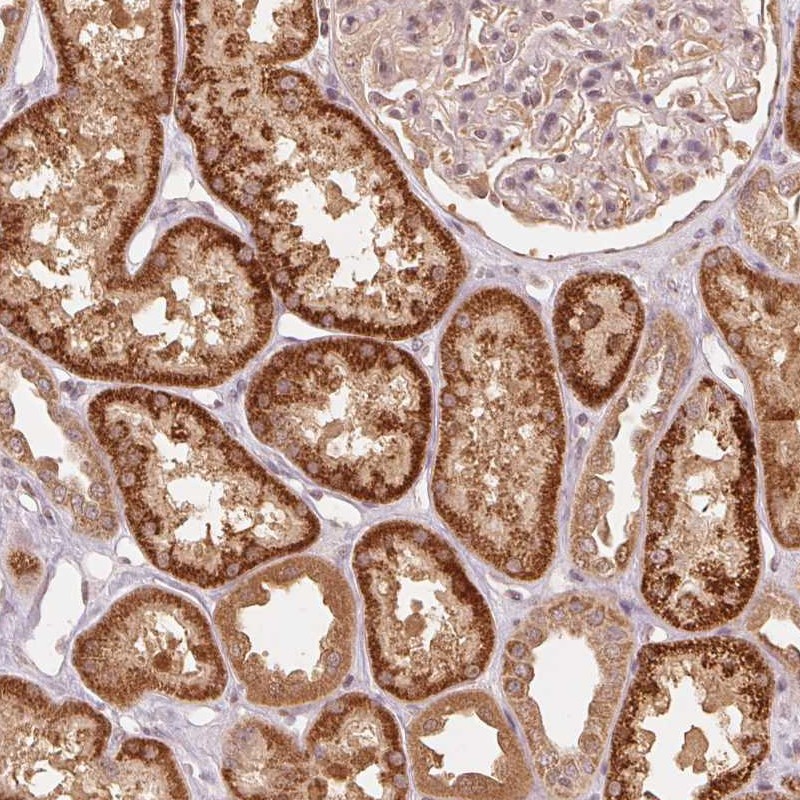 Atlas Antibodies Anti-C2orf73 Antibody