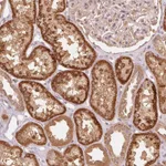 Atlas Antibodies Anti-C2orf73 Antibody