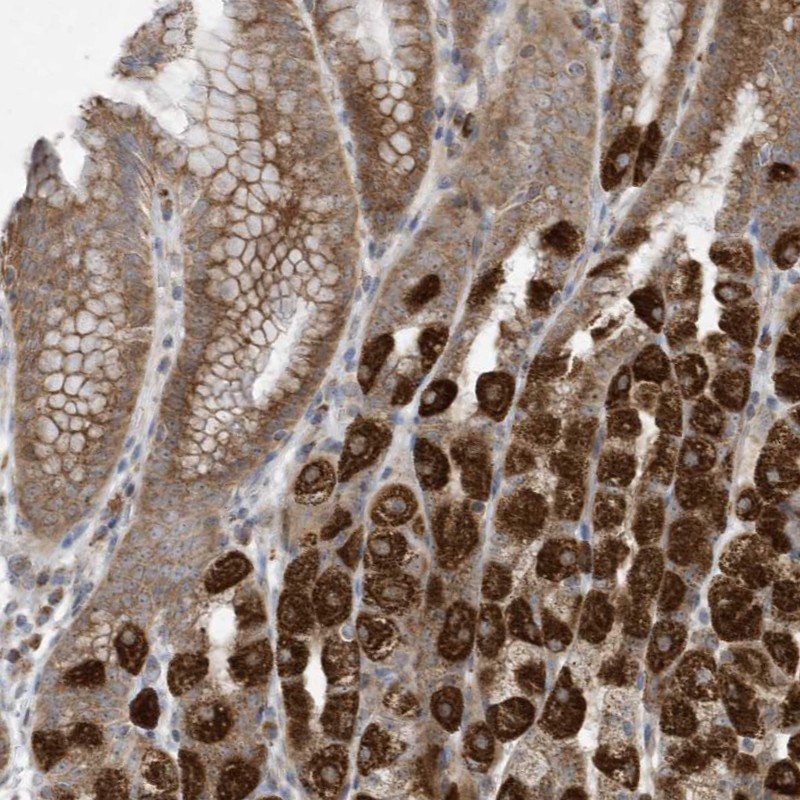 Atlas Antibodies Anti-C2orf74 Antibody