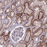 Atlas Antibodies Anti-C2orf76 Antibody