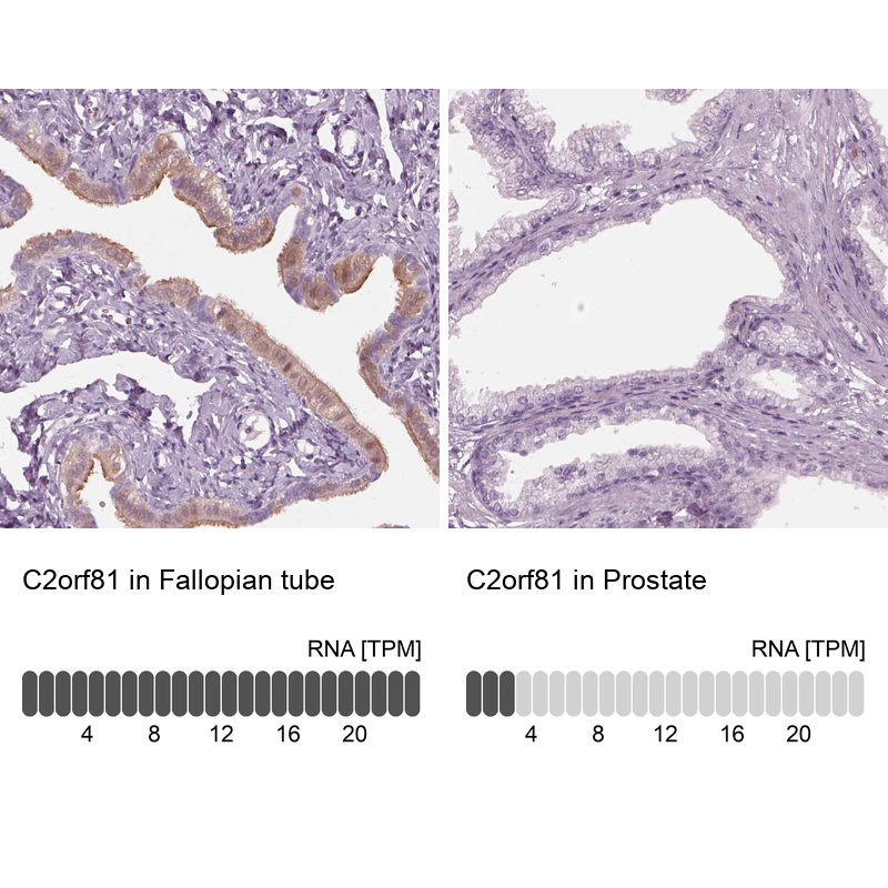 Atlas Antibodies Anti-C2orf81 Antibody