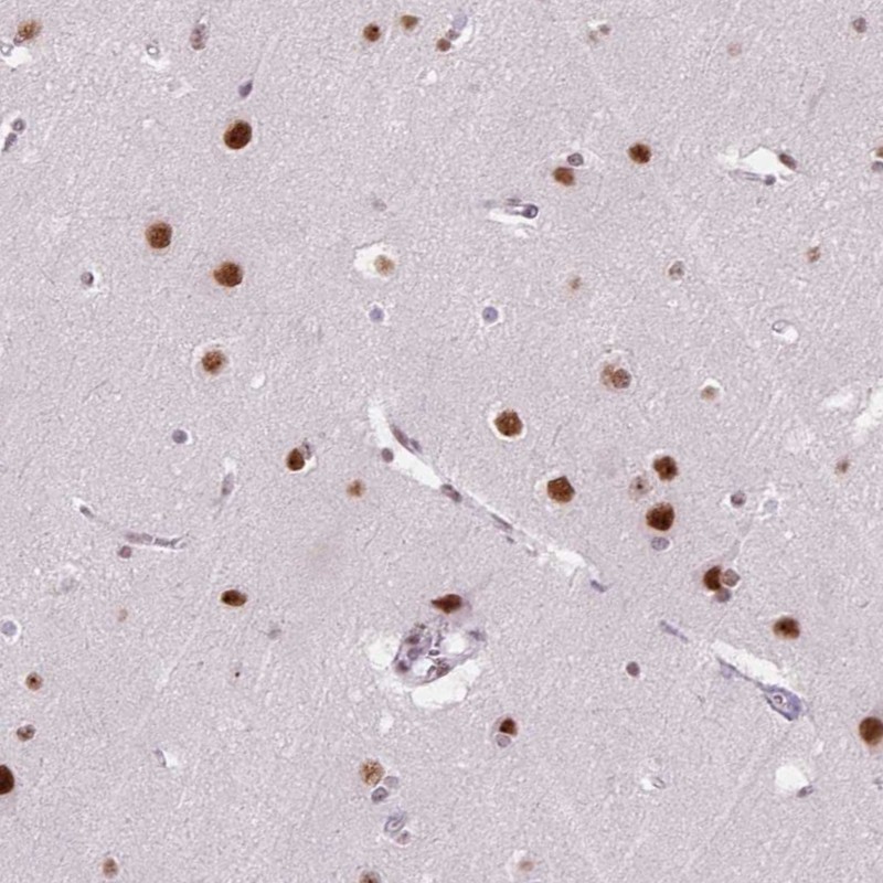 Atlas Antibodies Anti-C2orf82 Antibody
