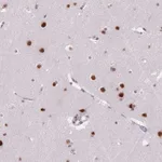 Atlas Antibodies Anti-C2orf82 Antibody