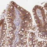 Atlas Antibodies Anti-C2orf88 Antibody