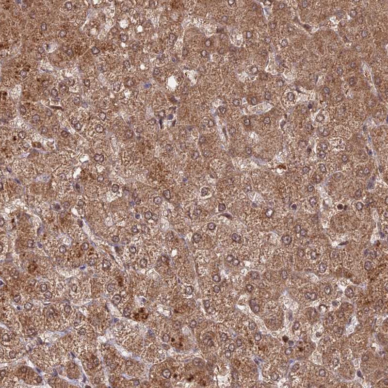 Atlas Antibodies Anti-C2orf91 Antibody