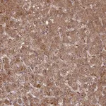 Atlas Antibodies Anti-C2orf91 Antibody