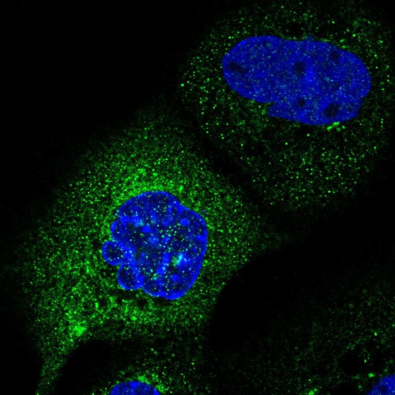Atlas Antibodies Anti-C2orf76 Antibody