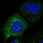 Atlas Antibodies Anti-C2orf76 Antibody