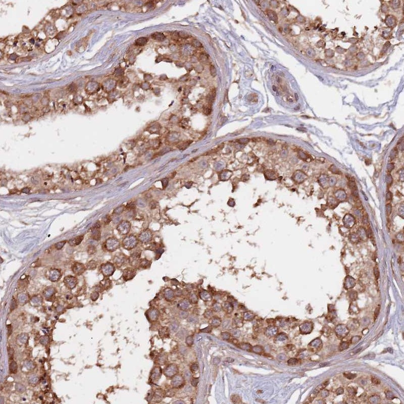 Atlas Antibodies Anti-C3orf14 Antibody