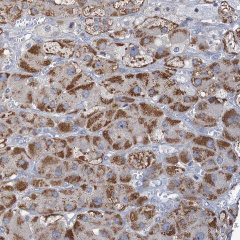 Atlas Antibodies Anti-C3orf18 Antibody
