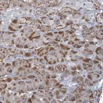 Atlas Antibodies Anti-C3orf18 Antibody