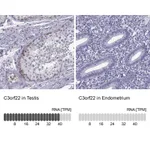 Atlas Antibodies Anti-C3orf22 Antibody