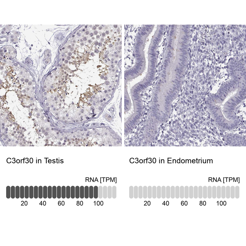 Atlas Antibodies Anti-C3orf30 Antibody
