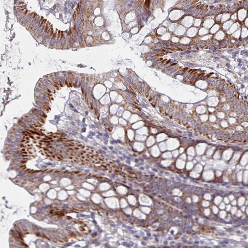 Atlas Antibodies Anti-C3orf36 Antibody