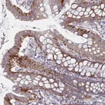 Atlas Antibodies Anti-C3orf36 Antibody